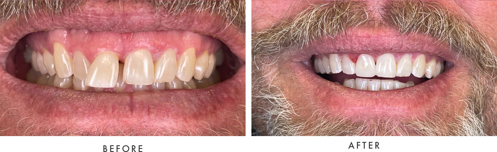 Wellington Family Dentistry & Implant Center before and after example model