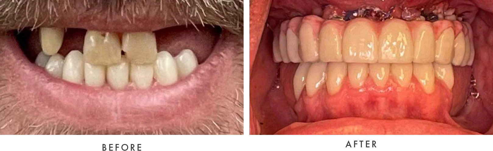 Wellington Family Dentistry & Implant Center before and after example model