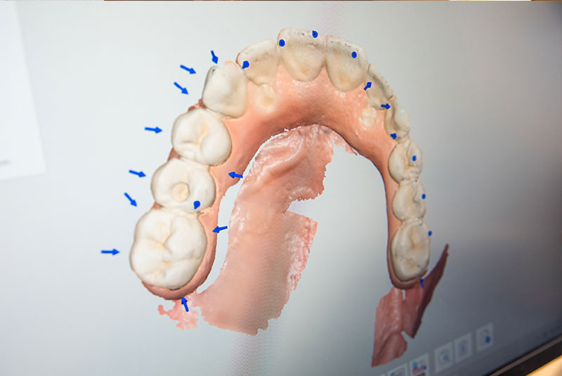 display image of scanned model of patient set arch